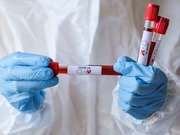 До 100 госслужащих заболевают коронавирусом в Нур-Султане ежесуточно - Минздрав
